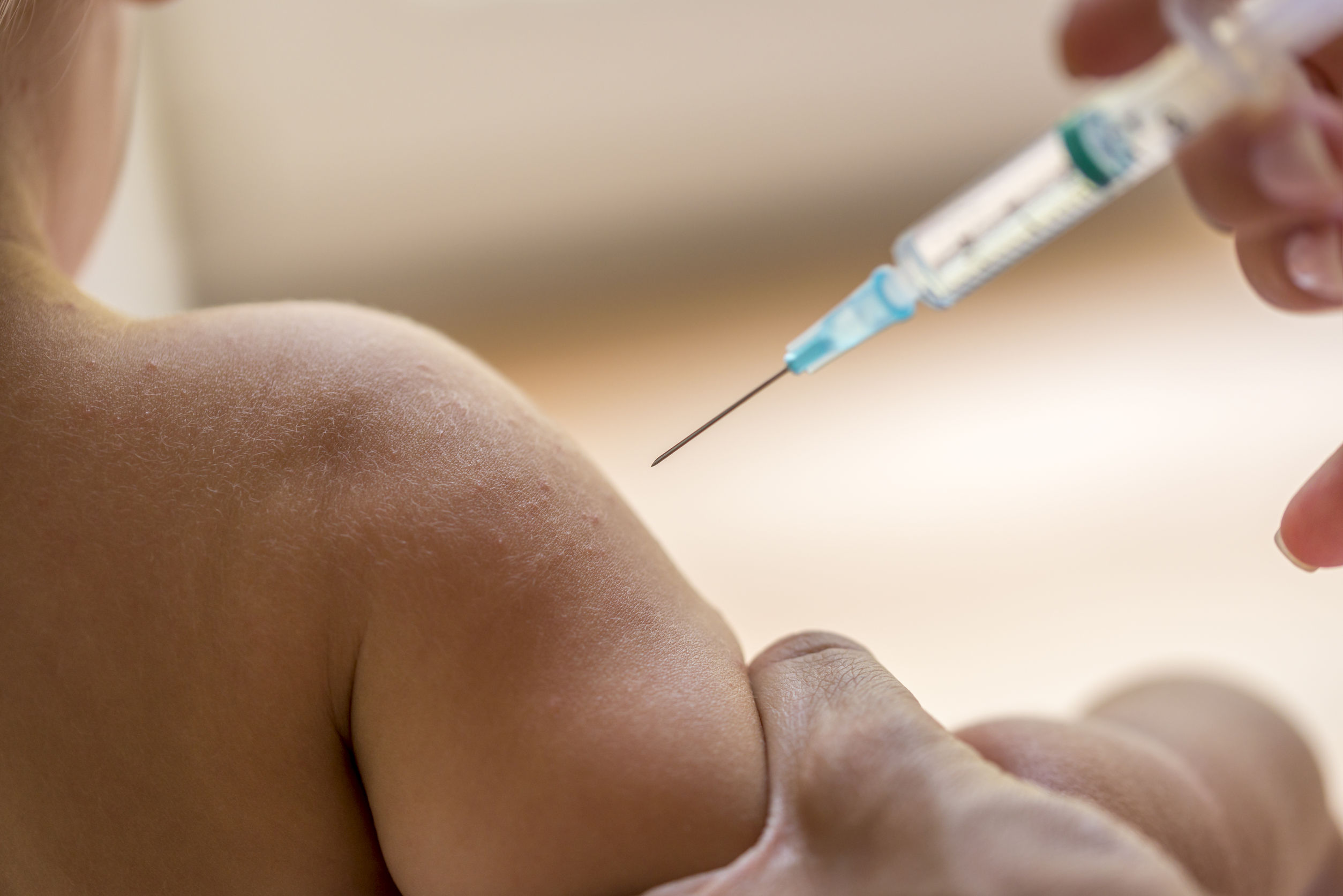 46180875 - doctor injecting a young child with a vaccination or antibiotic in a small disposable hypodermic syringe, close up of the kids arm and needle.